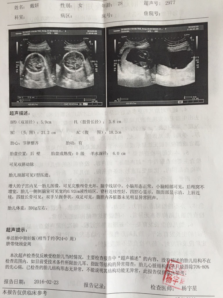 胎儿一侧侧脑室可见宽约0.