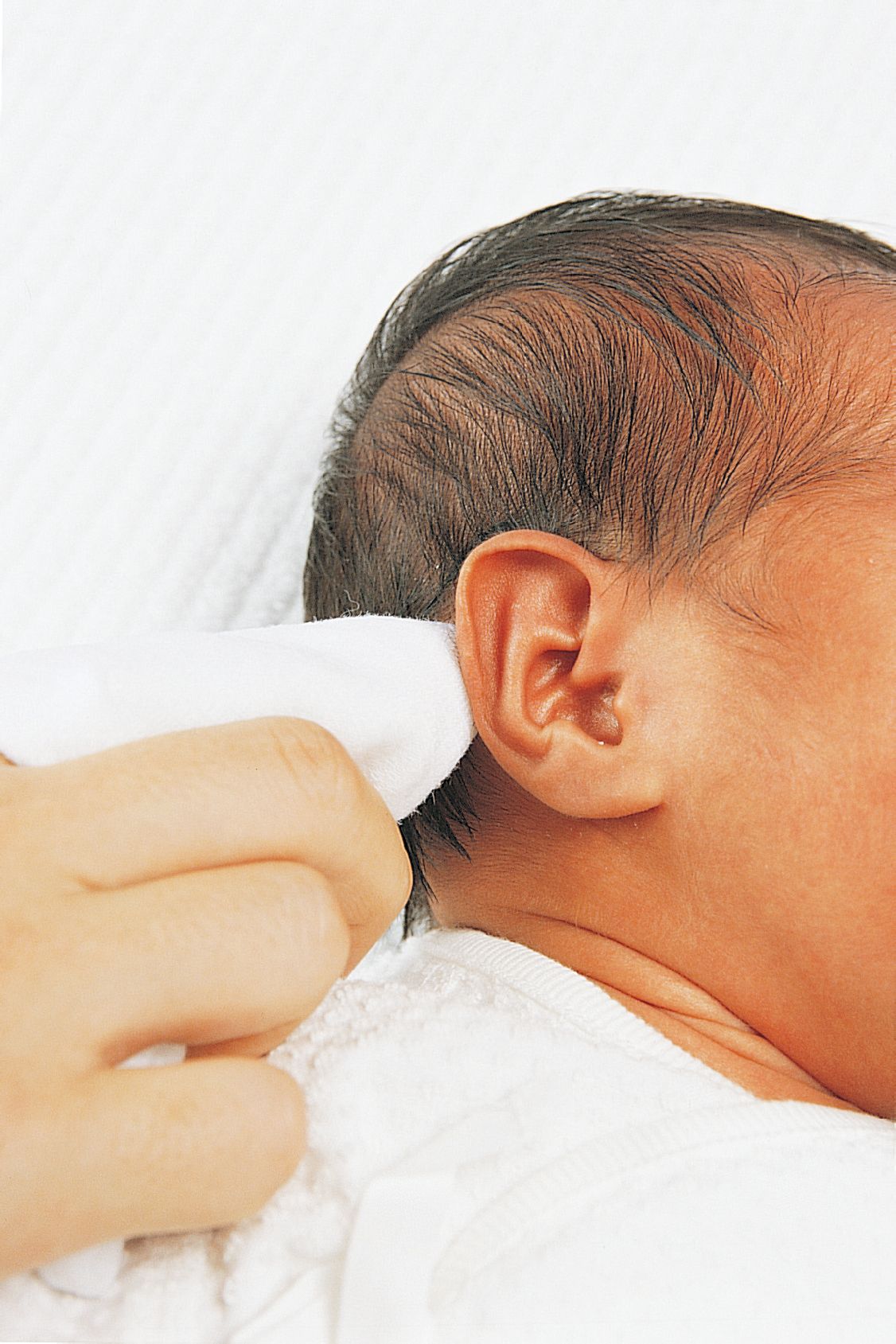 婴儿耳朵矫正（新生儿耳廓畸形）-幼儿百科-魔术铺