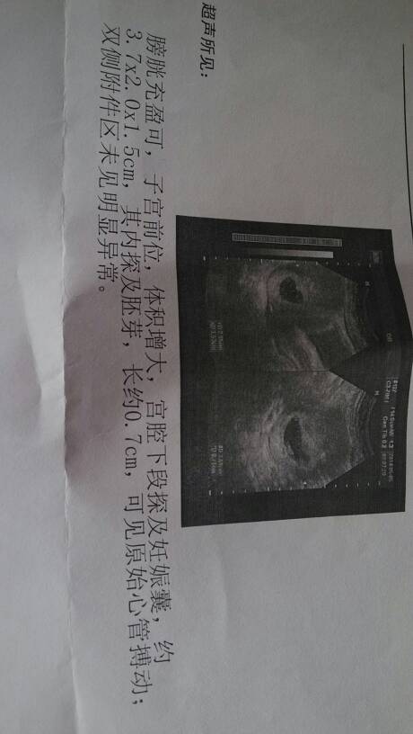 请教专家,帮我看看这胎能不能保住,谢谢!怀孕50天了,彩超如下