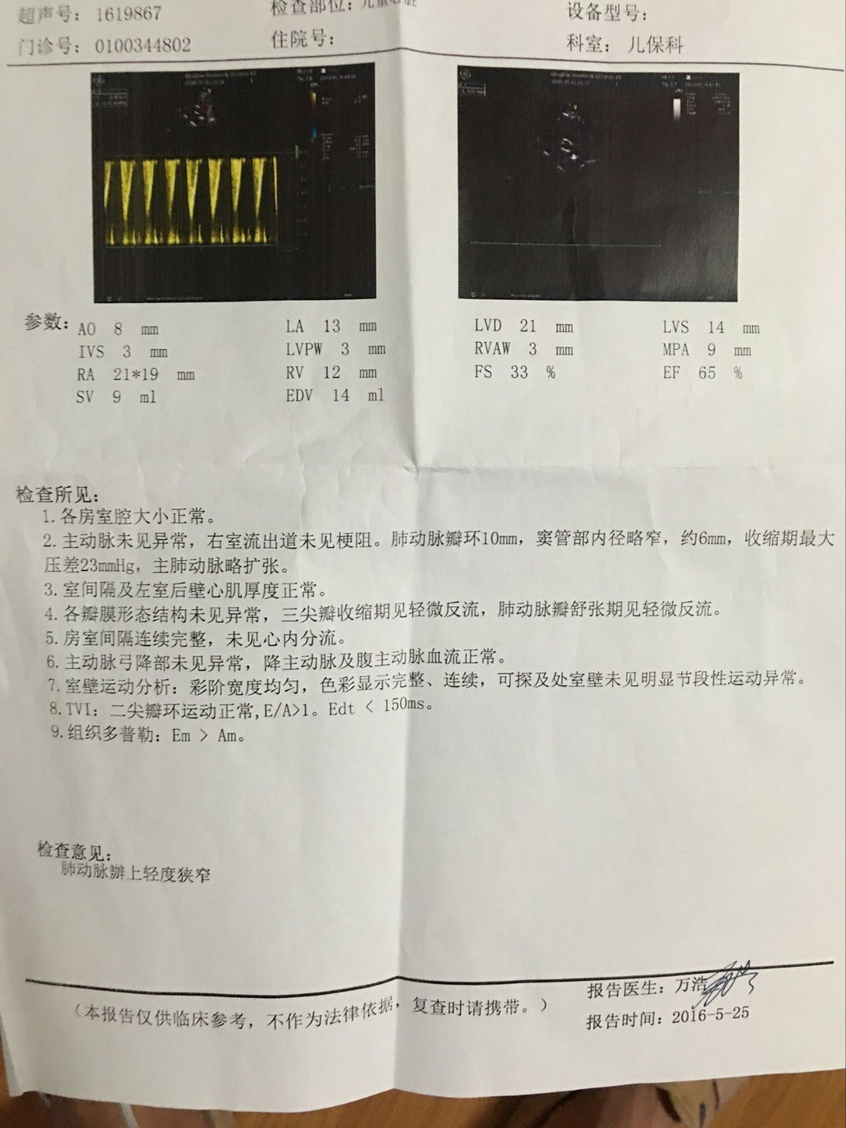 还是有点担心所以问问医生 1:等长大了窦管