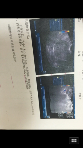 怀孕15天之内可以用b超明确地看到孩子的大小吗有图片麻烦知情人士