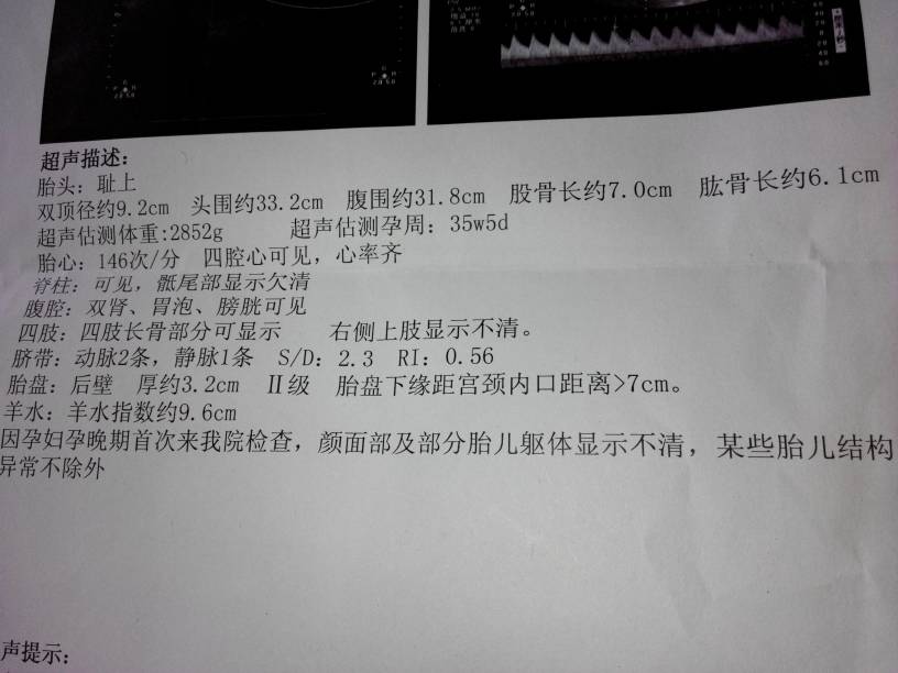 我的b超 36周加5天做的 看看跟我的孕周相符吗?