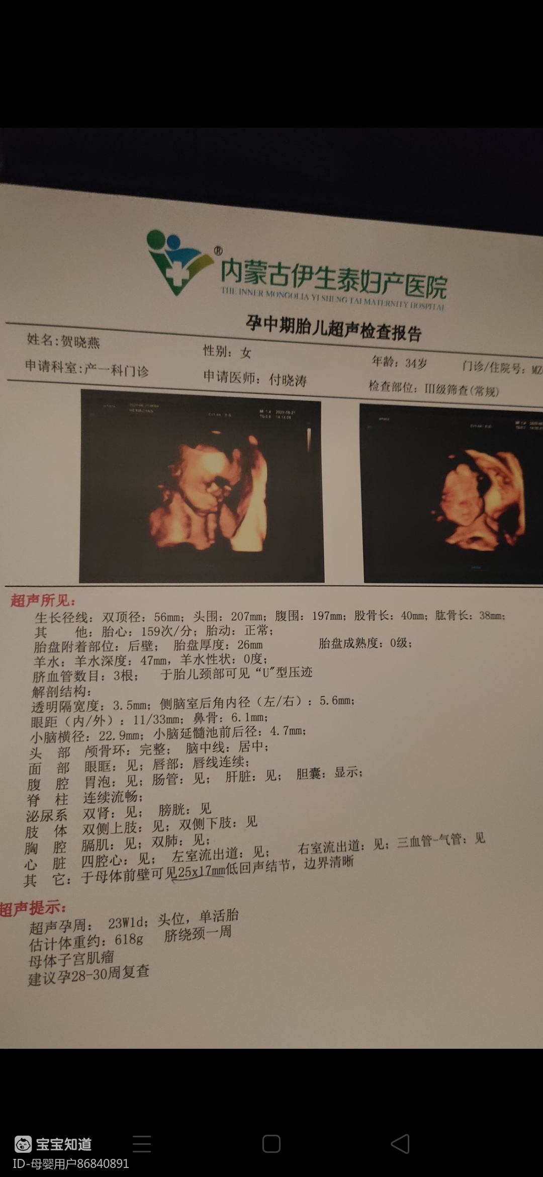 宝妈们昨天刚做的四维彩超帮忙看看怀的是男孩儿还是女孩儿