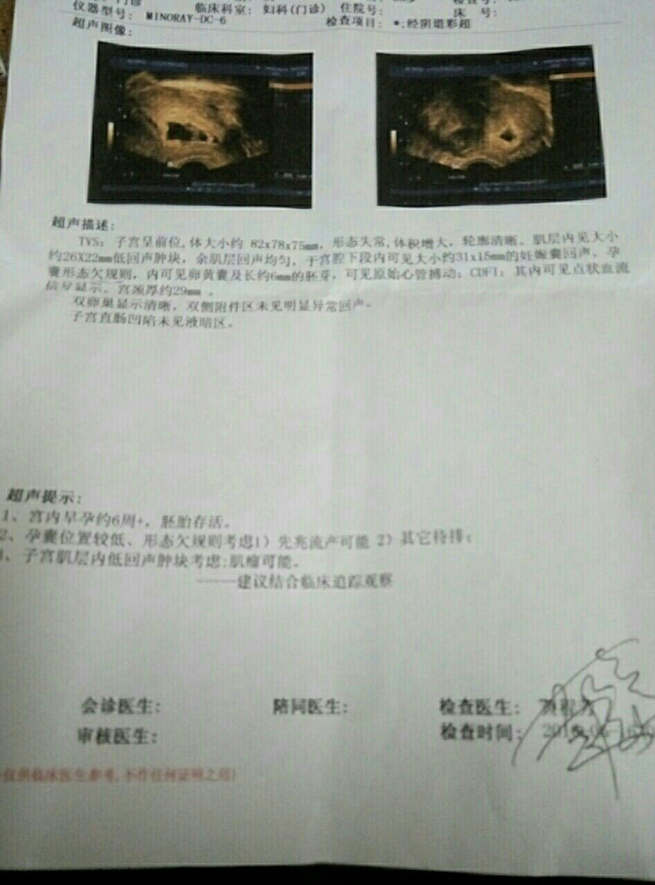 热 胎囊看男女!准确率高!请已经知道男女宝妈们带b超来验证!