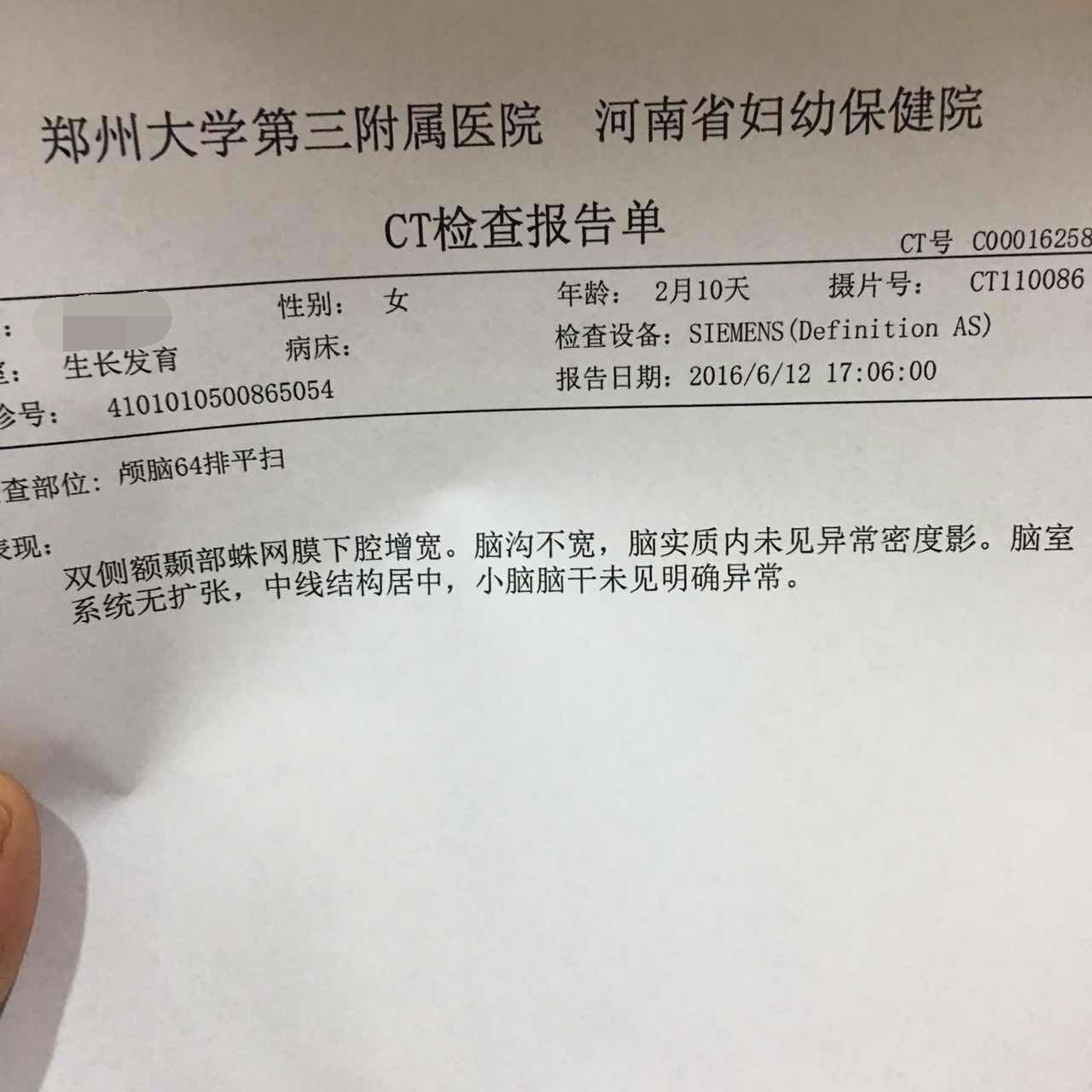 两个月10天的女宝宝检查脑ct诊断结果:双侧额颞部蛛网膜下腔增宽 建议