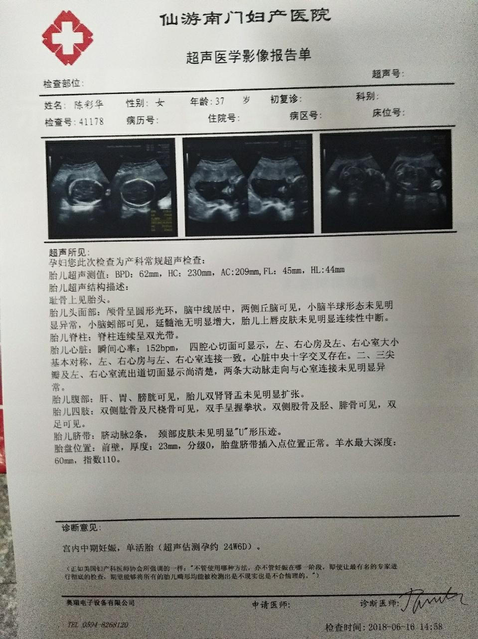 热 孕期产检四维彩超一次过?拿好这些秘诀孕妇一次过!