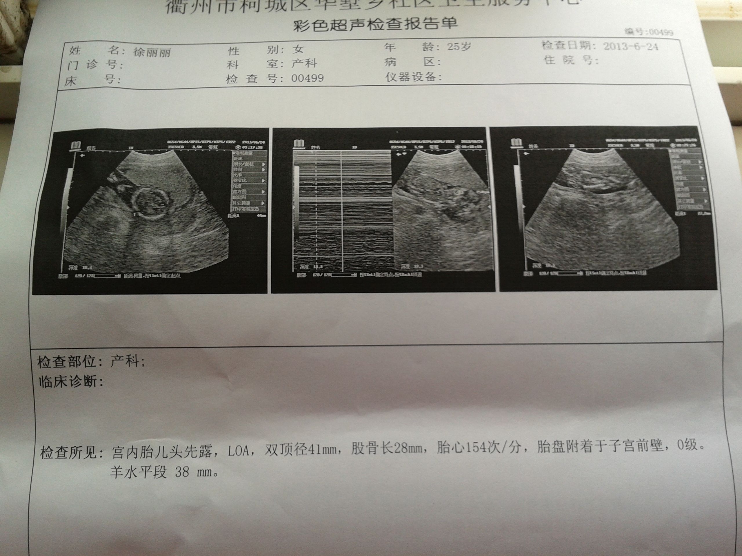 问答 问答首页胎盘附着于子宫前壁,0级,羊水平段38mm 请问各位知心人