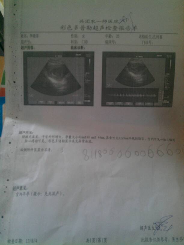 请专家看看怀孕65天的b超,上面意见(先兆流产),是怎么