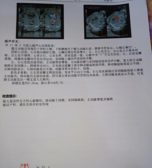 胎儿复杂性先天性心脏畸形可以保留吗?出生后治疗方法和效果怎么样?