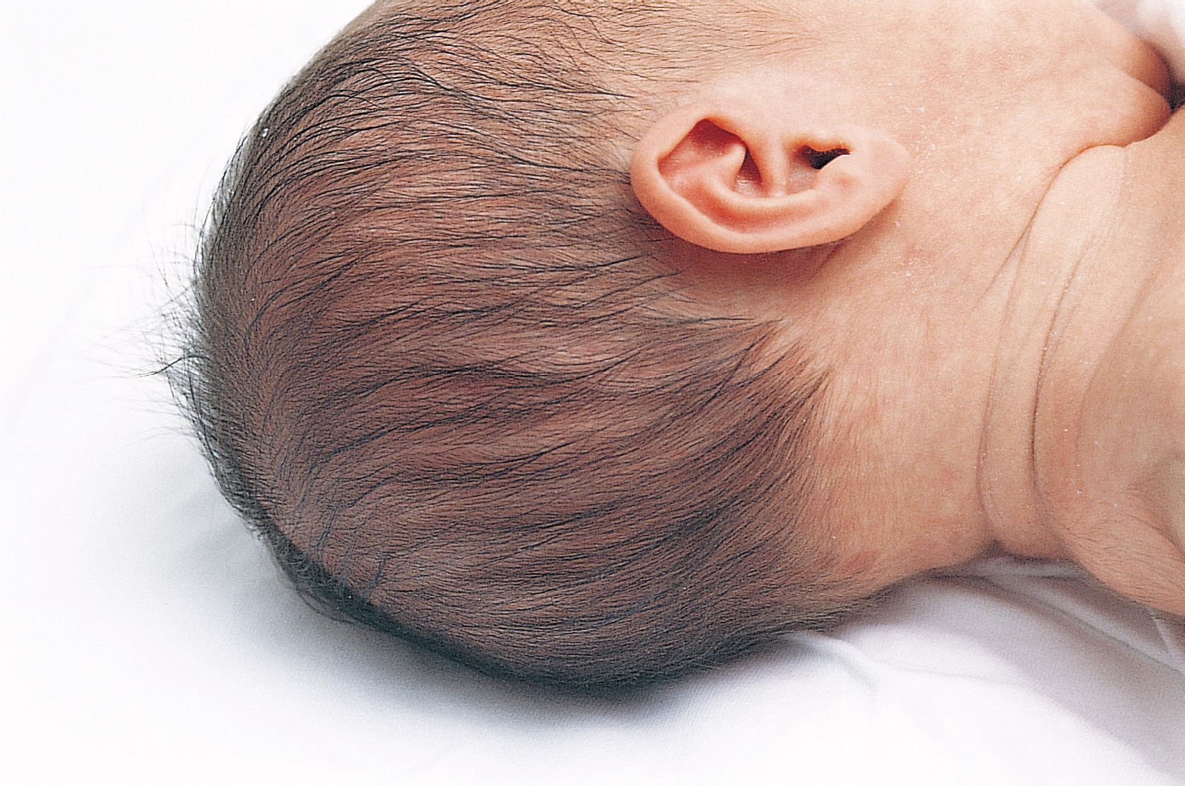 【宝宝头型】教你如何睡出小圆头！|||️常见正常问题头型特征 - 知乎