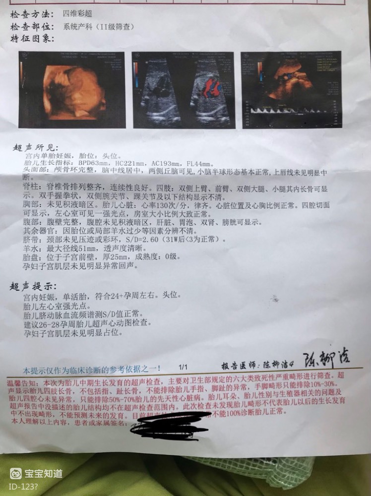 四维b超检查单虽然很想知道你是男宝宝还是女宝宝一天照了第四次才