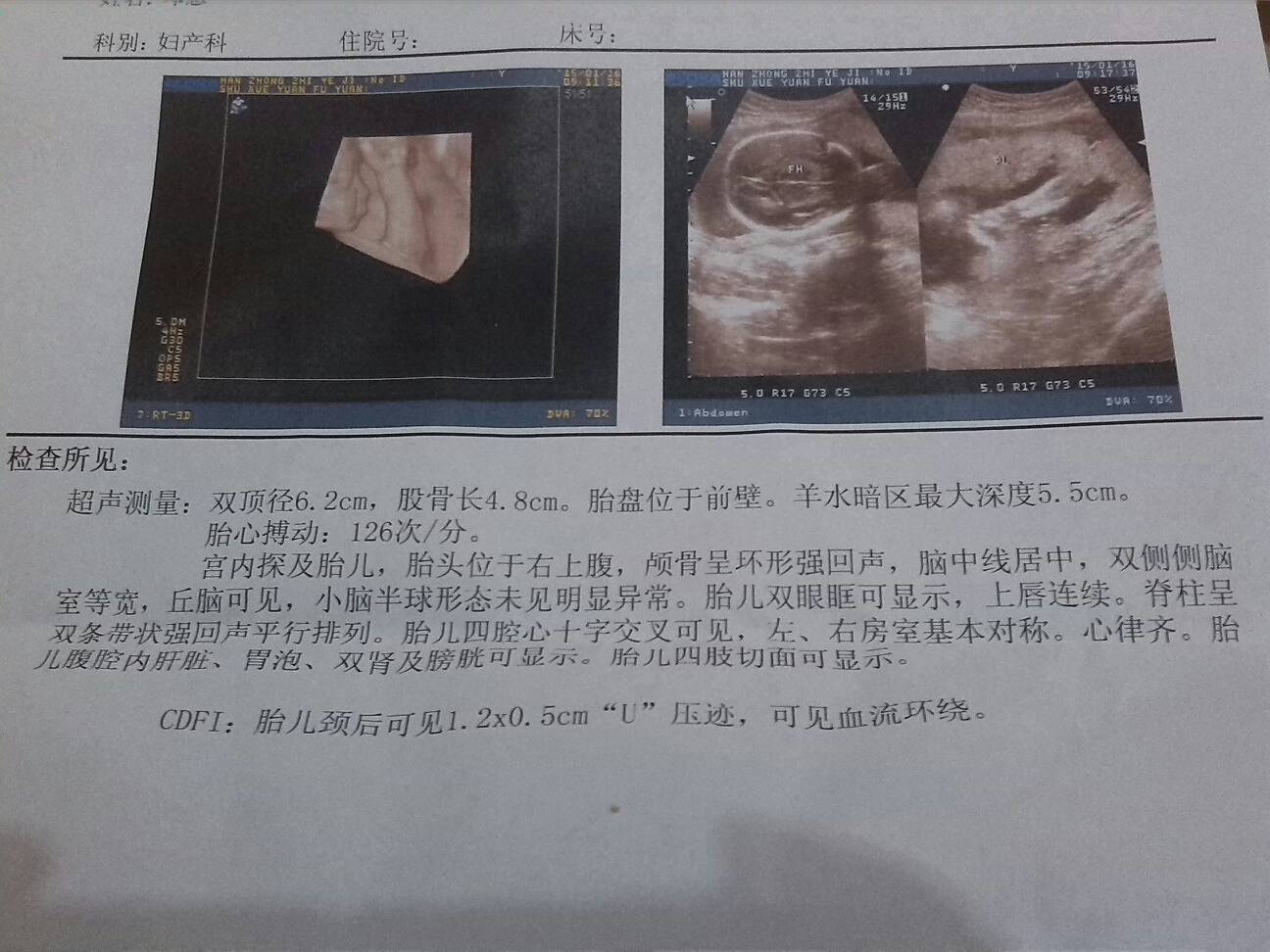 孕23周,做的四维,帮忙看一下是男宝还是女宝
