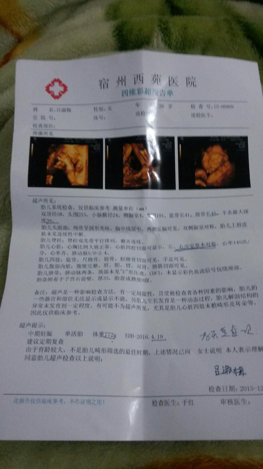 今天去做了四维彩超,看不出来男孩女孩,宝妈们帮忙看看