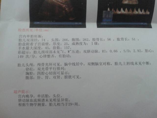 我怀孕31周 做1级产前超声检查 结果是胎儿相当于29 周 胎儿偏小 对