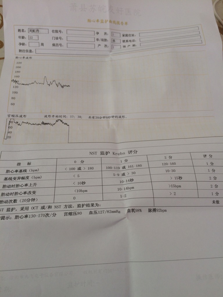 40周做的胎心监护帮我看看正常吗?