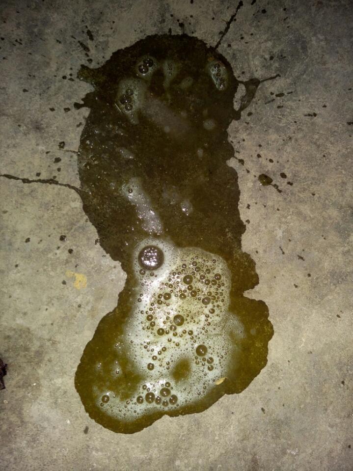 宝宝上吐下泻怎么回事?这是吐的水