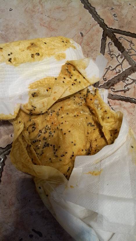 紧急,各位宝妈医生们,我宝宝刚刚拉肚子,给他换尿不湿的时候发现,身上