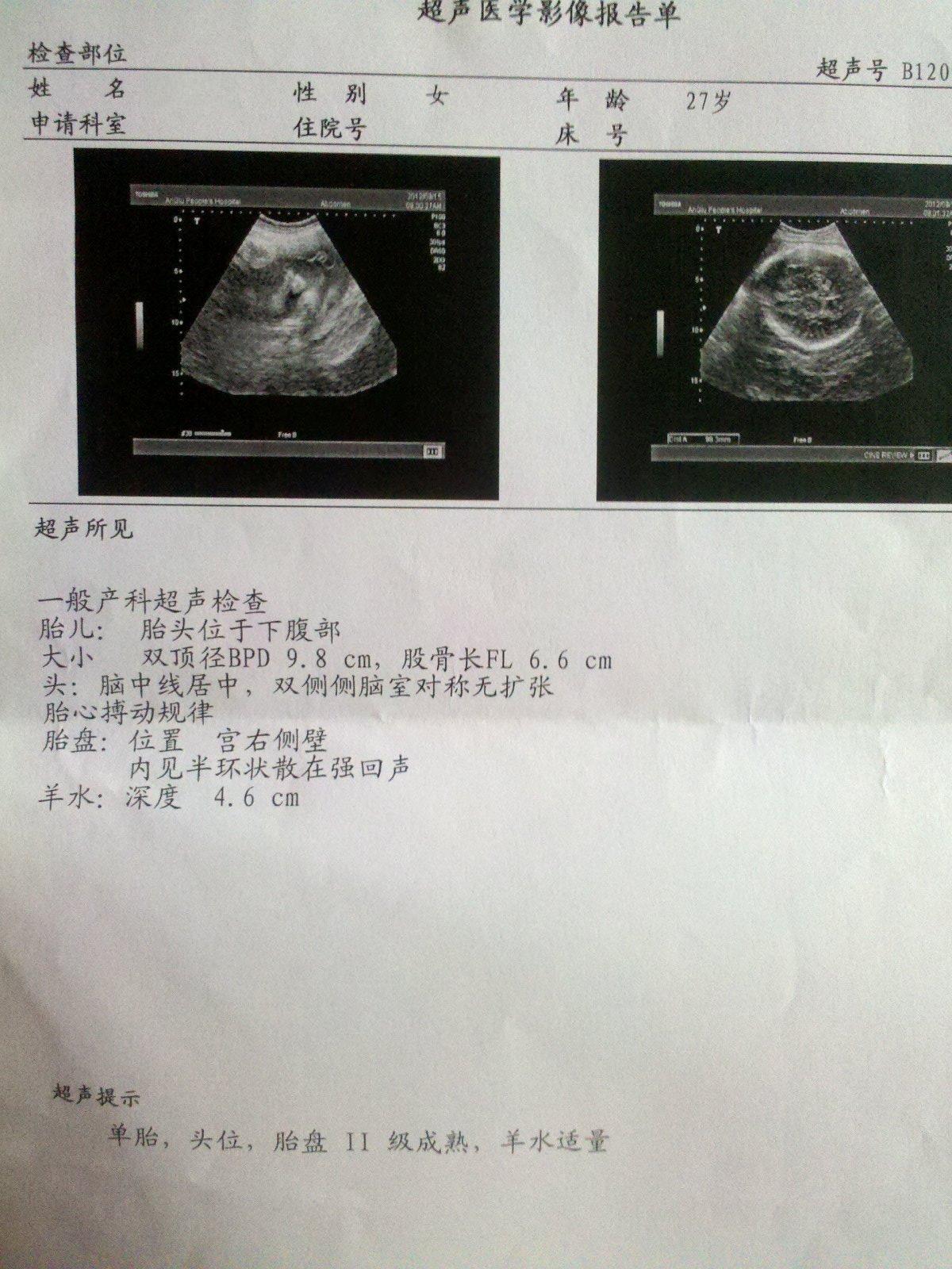 准妈妈怀孕十月需要做多少怀孕b超报告单__财经头条