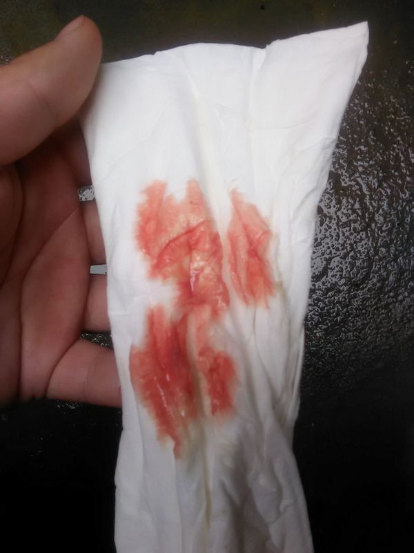 怀孕七个多月一个礼拜前流了点暗红色血,吃了保胎药检查也都没事,阴历