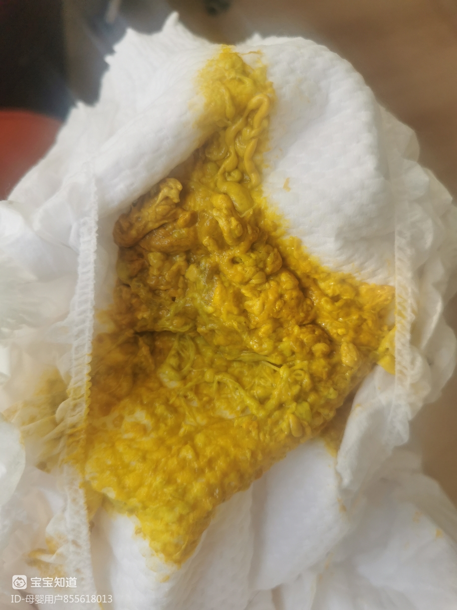 请问各位宝妈,四个月宝宝的臭臭这样正常吗?