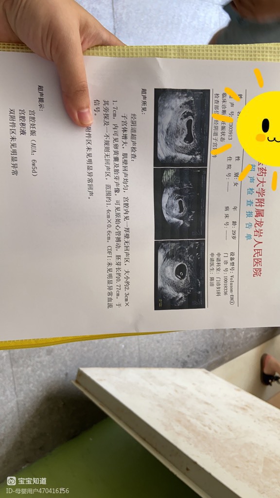 孕7周阴超图来了祈祷平安健康长大