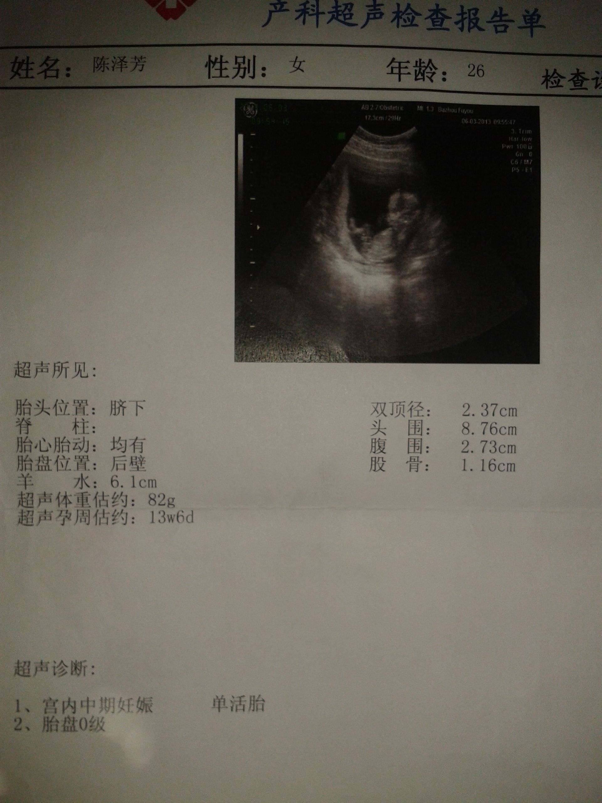 请问怀孕初期b超单图片制作-怀孕单子抽血检查报告图片制作 - 知乎