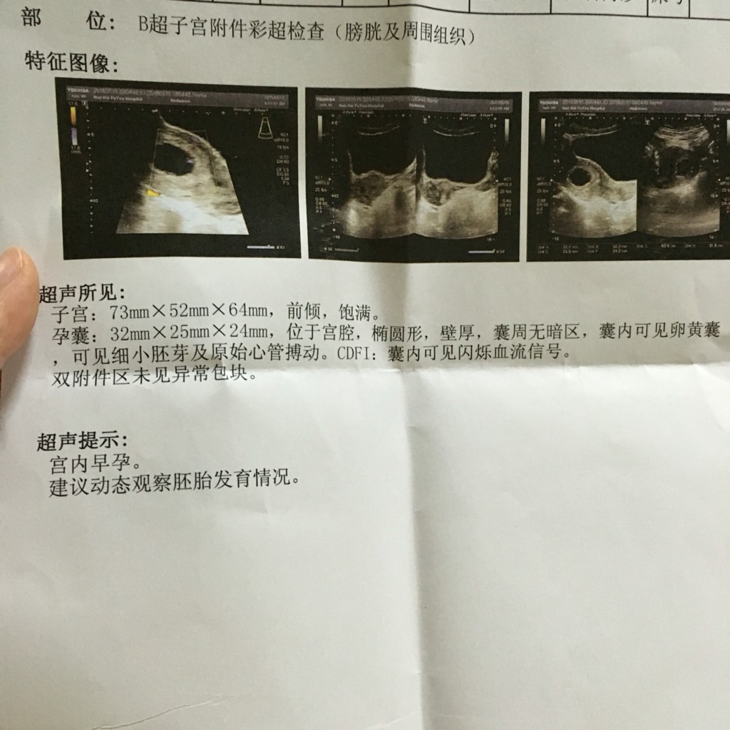 28岁卵巢早衰amh1.07调理两个月怀孕，B超见健康胎心胎芽！ - 知乎