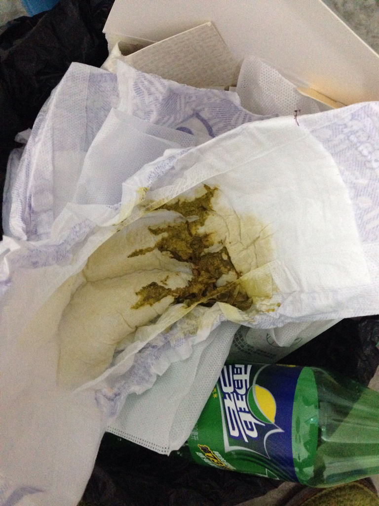 宝宝大便正常不?