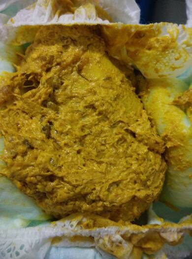 宝宝九个月前两天开始拉这种大便的平时没什么～就是白天睡觉多了