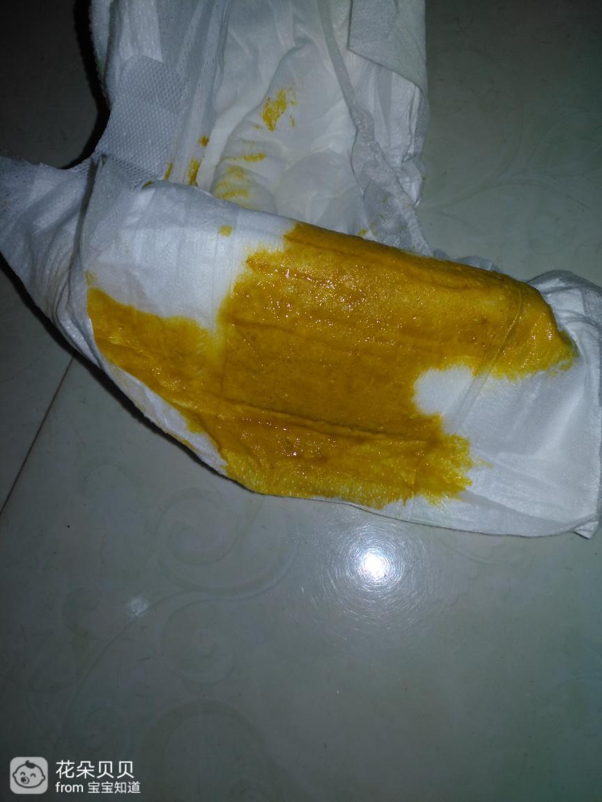 我家宝宝3个月多月，拉金黄色便便正常吗？是母乳奶粉混养母乳为主拉这种便便正常吗？求宝妈们帮助急