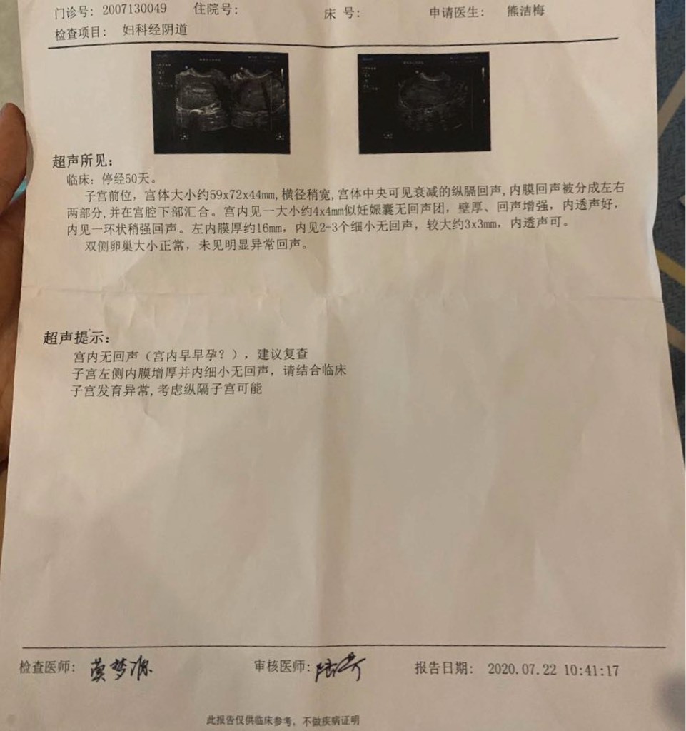 纵横子宫,停经50天,怀孕七周只有孕囊,孕酮和人绒毛膜促性腺激素都