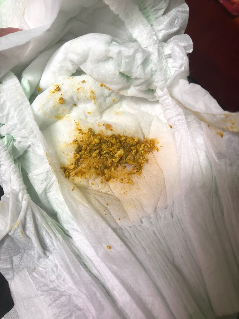 出生27天了,最近3天宝宝红屁股了,每次拉屎一点点带颗粒一天好几次