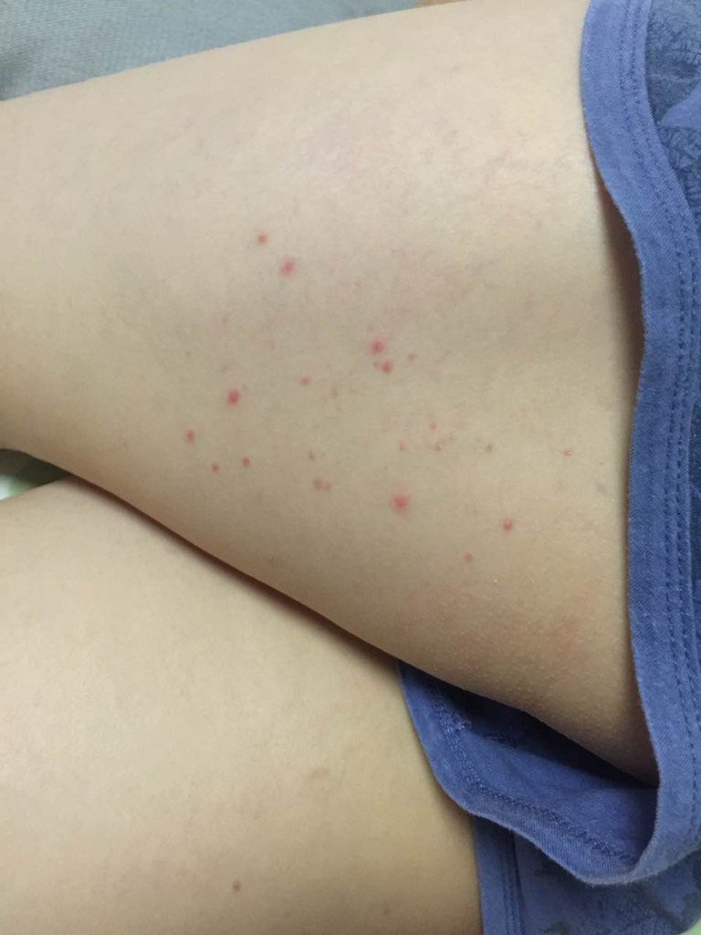 宝妈们,帮我看看这是长得什么鬼东西啊?