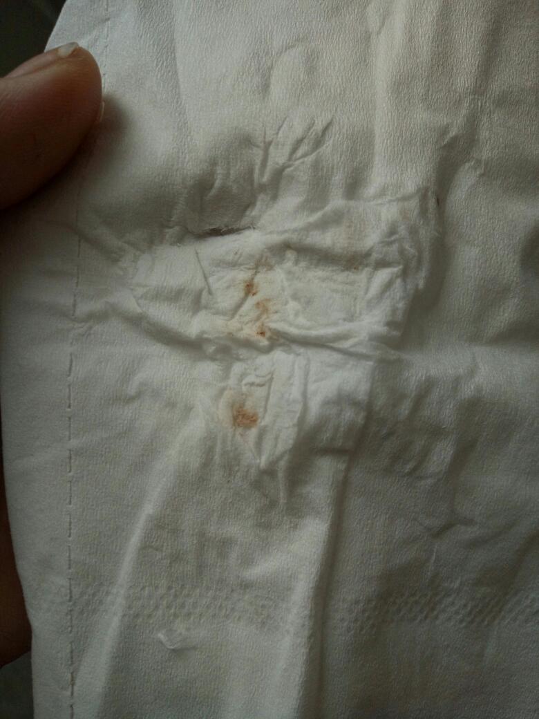 怀孕五周有褐色分泌物