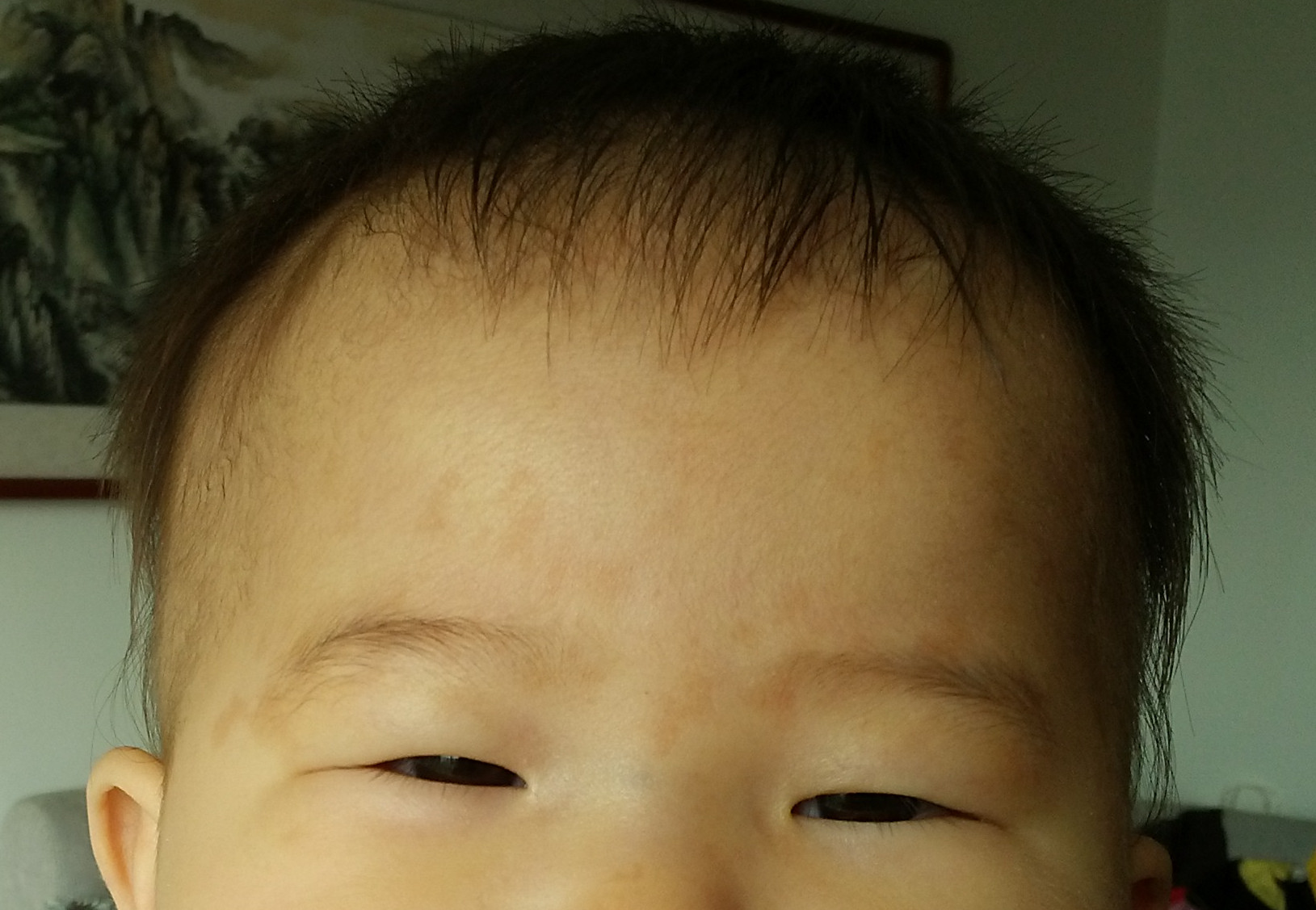 婴儿脸上红斑，出生到现在已经7个月大了，该处红斑从出生到现在一直未消退（欢迎不倒翁52 继续回 - 百度宝宝知道
