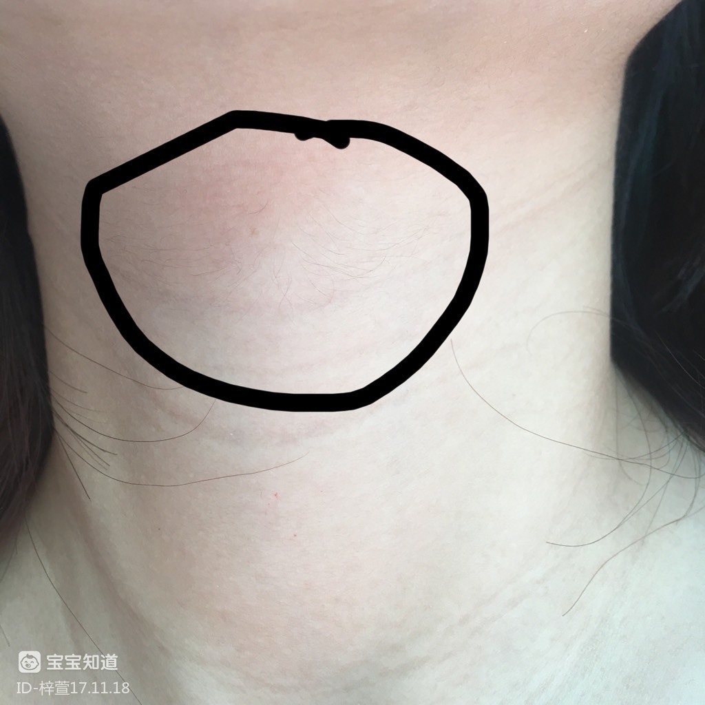 孕期你们脖子长毛了吗突然发现自己脖子都长毛了