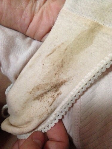 怀孕内裤上有褐色分泌物,以前没有,9周 怎么回事?