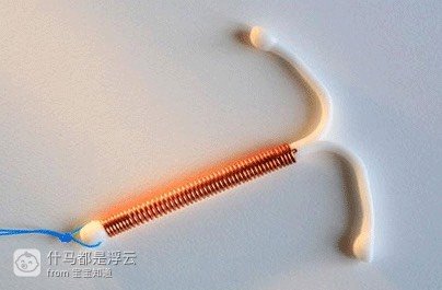 [分享]节育环移位 这些症状要警惕