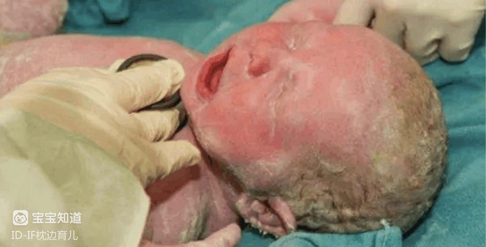 新生儿的这三个部位越丑长大后越好看家长偷着乐吧