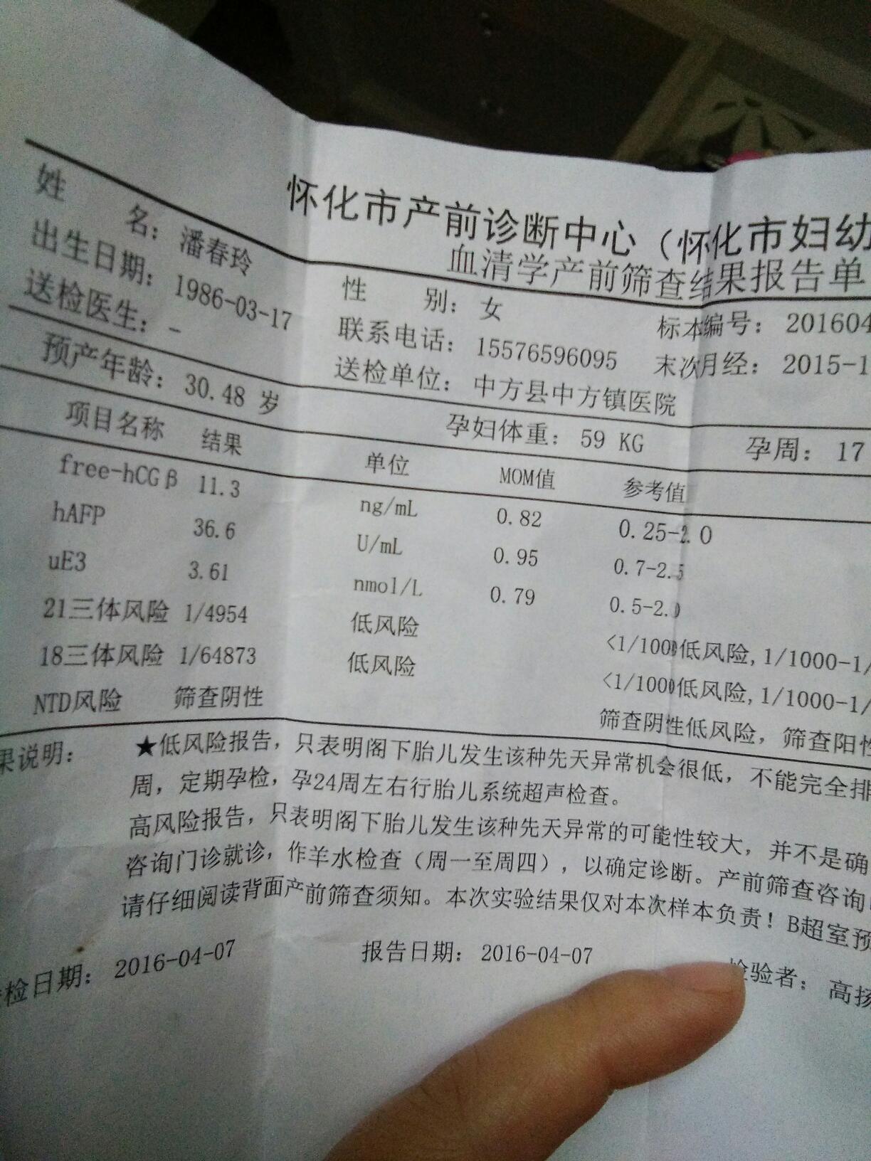 唐氏綜合症(21三體)偏高,,屬高危