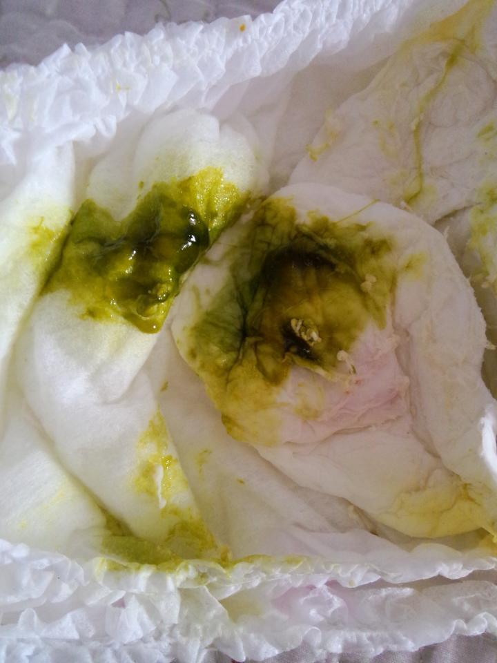 八个月半的宝宝拉着这样的屎是怎么回事?