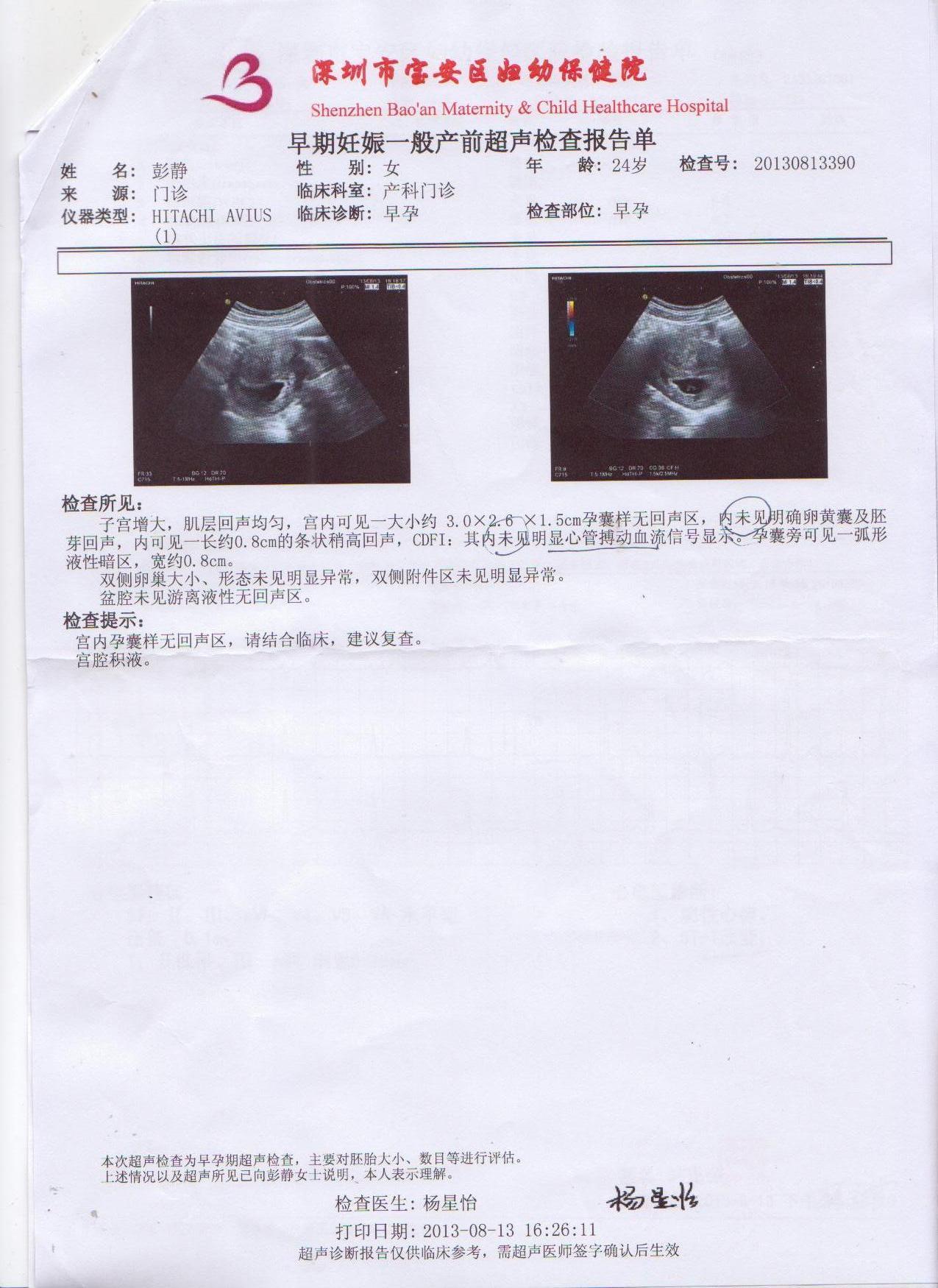 生男孩的孕囊形状图片-图库-五毛网