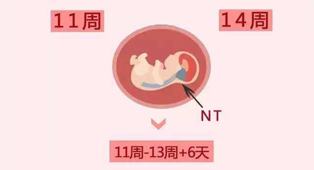 孕妇nt检查：做nt不知道这些就等于白做！ 百度宝宝知道