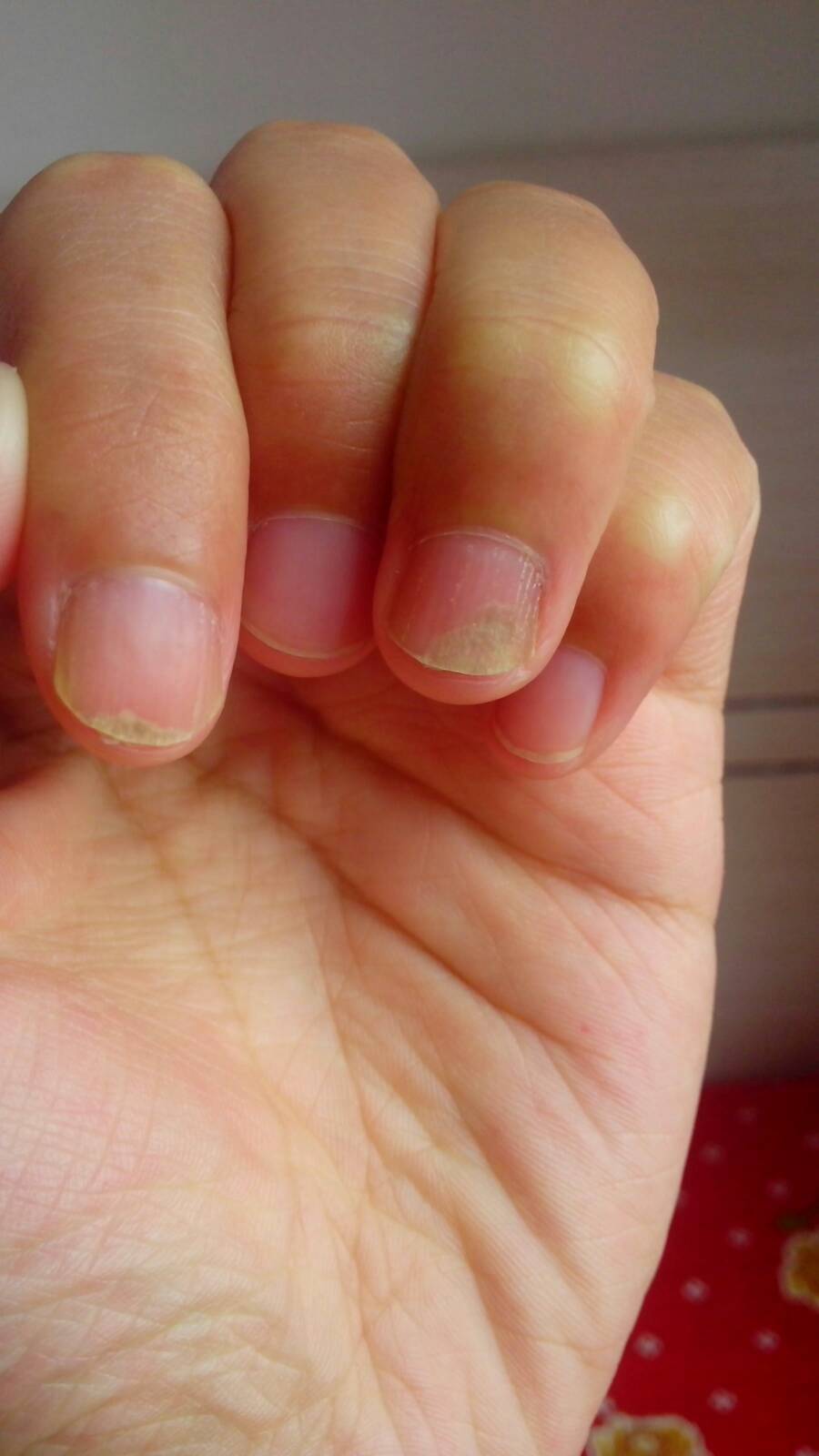 我得手指甲怎么了这是?都空了长了两层,还吃些什么呢?我在哺乳期呢!