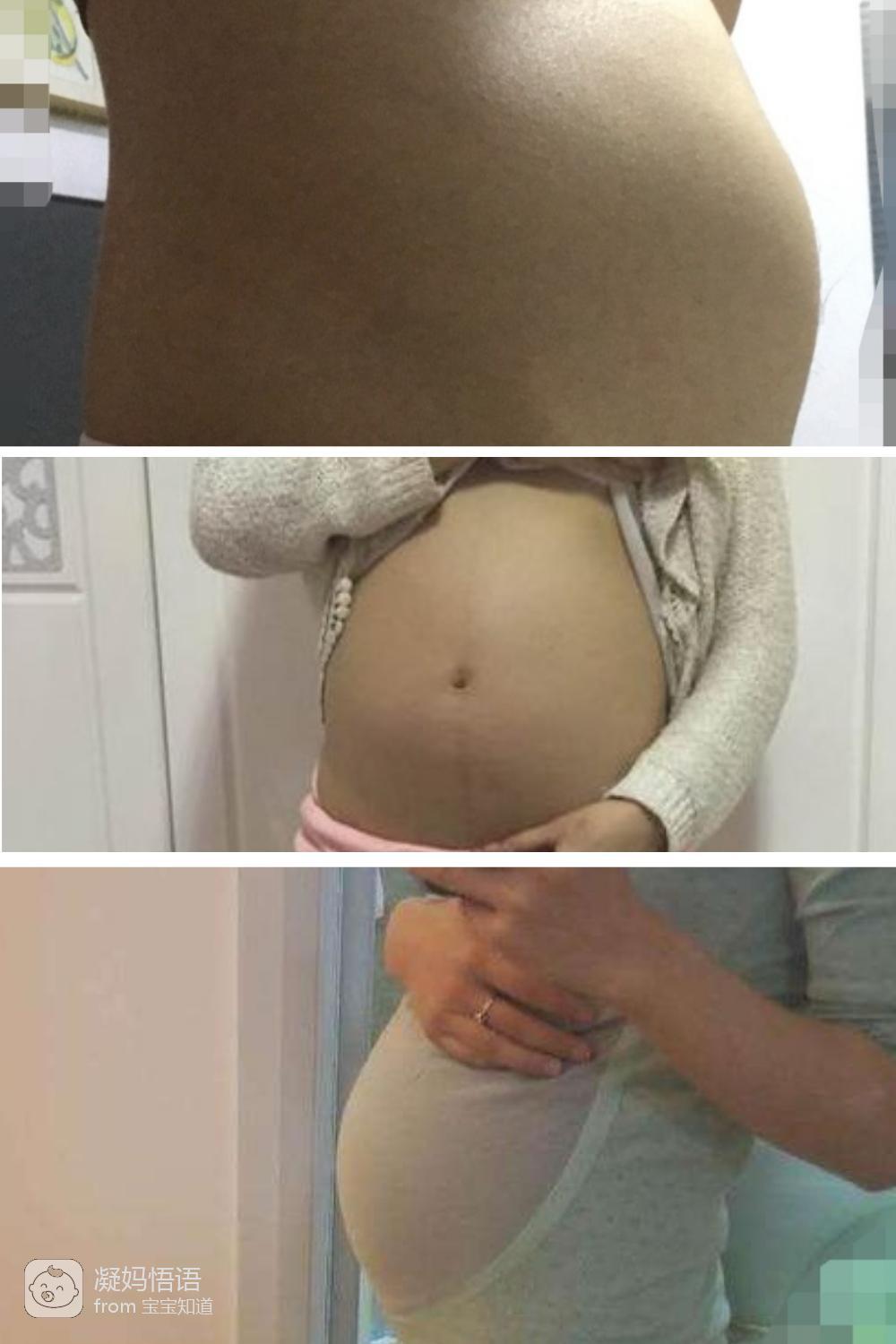 17周孕妇肚子有多大?这几张照片一目了然,