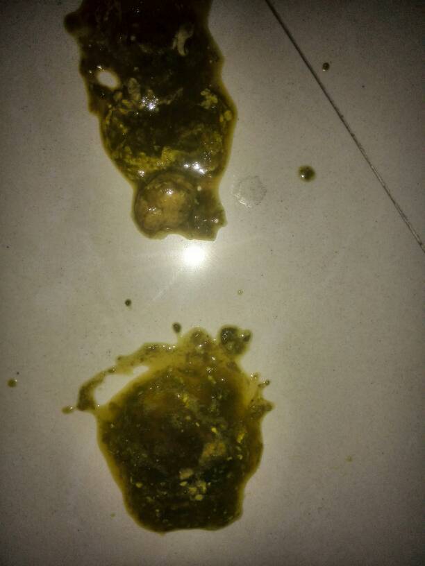 宝宝的大便这型状,肠胃不好消化不良怎么办?