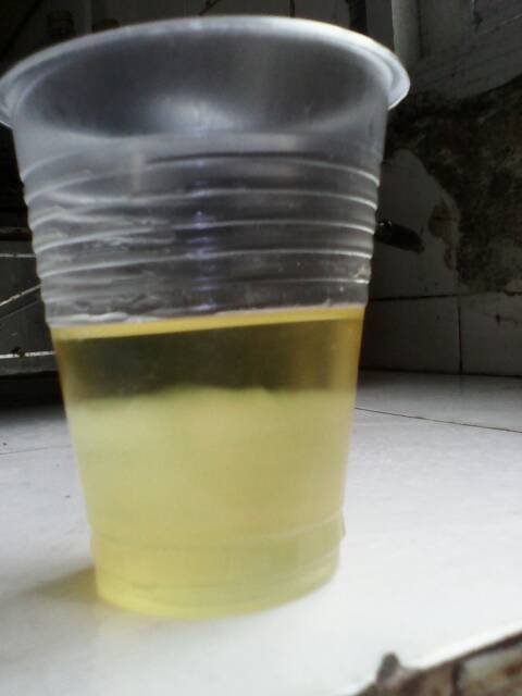 哪位宝妈使用过酒精加晨尿验男女的,有经验的帮我看看这是男是女