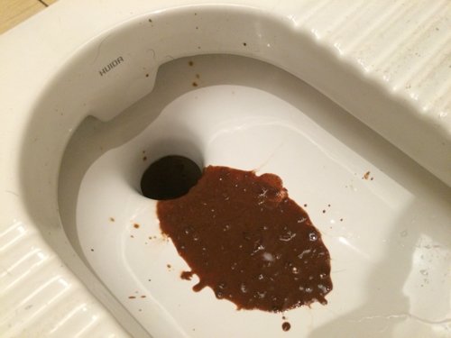 肚子一直胀胀的,因为是孕妇,也没吃什么特殊的东西