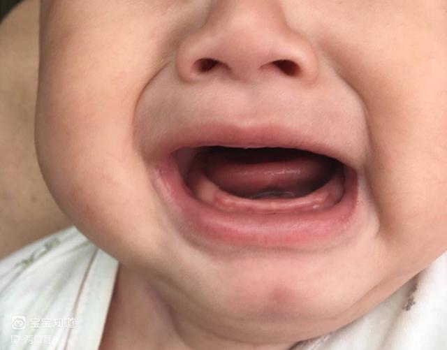 宝宝出牙前有症状对照出牙时间和顺序看看你家娃有没有达标