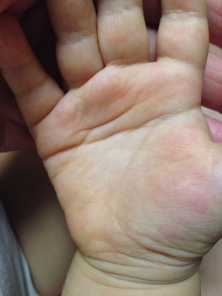 我家宝宝这手纹属于断掌纹吗